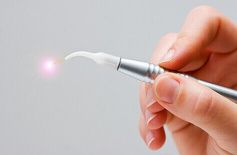 Laserzahnmedizin